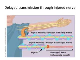Delayed transmission through injured nerve