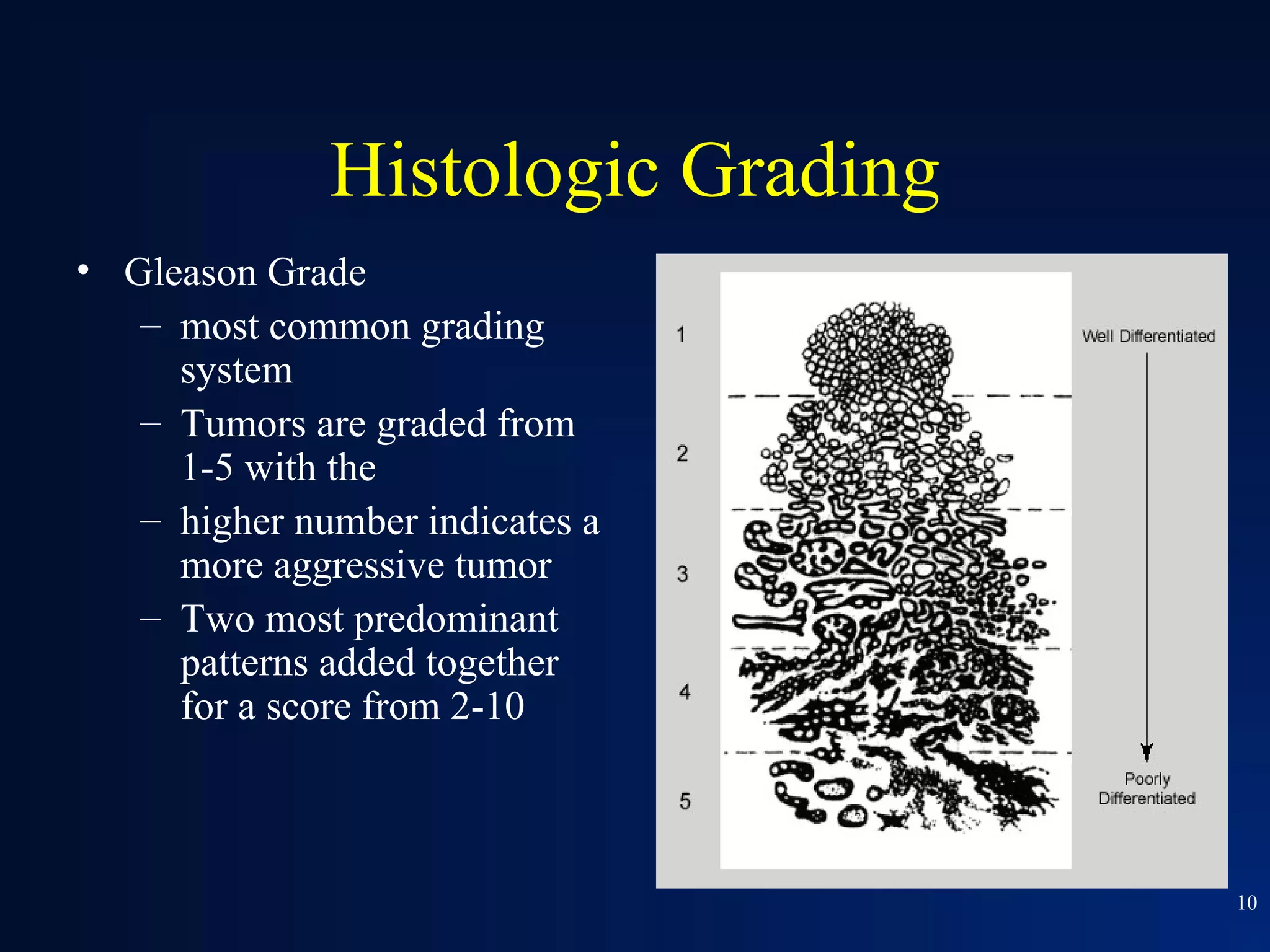Histologic Grading
• Gleason Grade
   – most common grading
     system
   – Tumors are graded from
     1-5 with the
   – higher number indicates a
     more aggressive tumor
   – Two most predominant
     patterns added together
     for a score from 2-10



                                   10
 