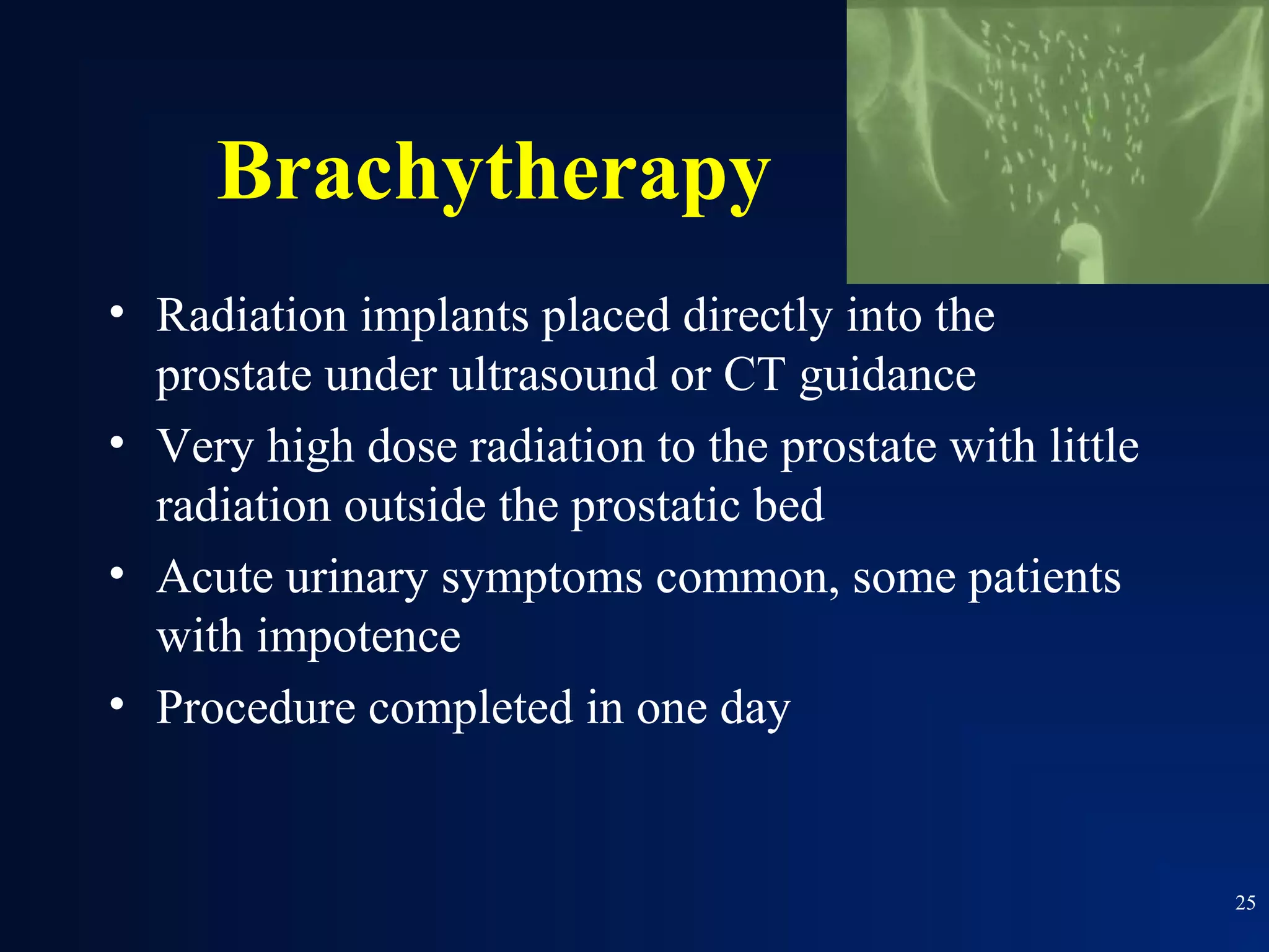 Brachytherapy
• Radiation implants placed directly into the
  prostate under ultrasound or CT guidance
• Very high dose radiation to the prostate with little
  radiation outside the prostatic bed
• Acute urinary symptoms common, some patients
  with impotence
• Procedure completed in one day


                                                         25
 