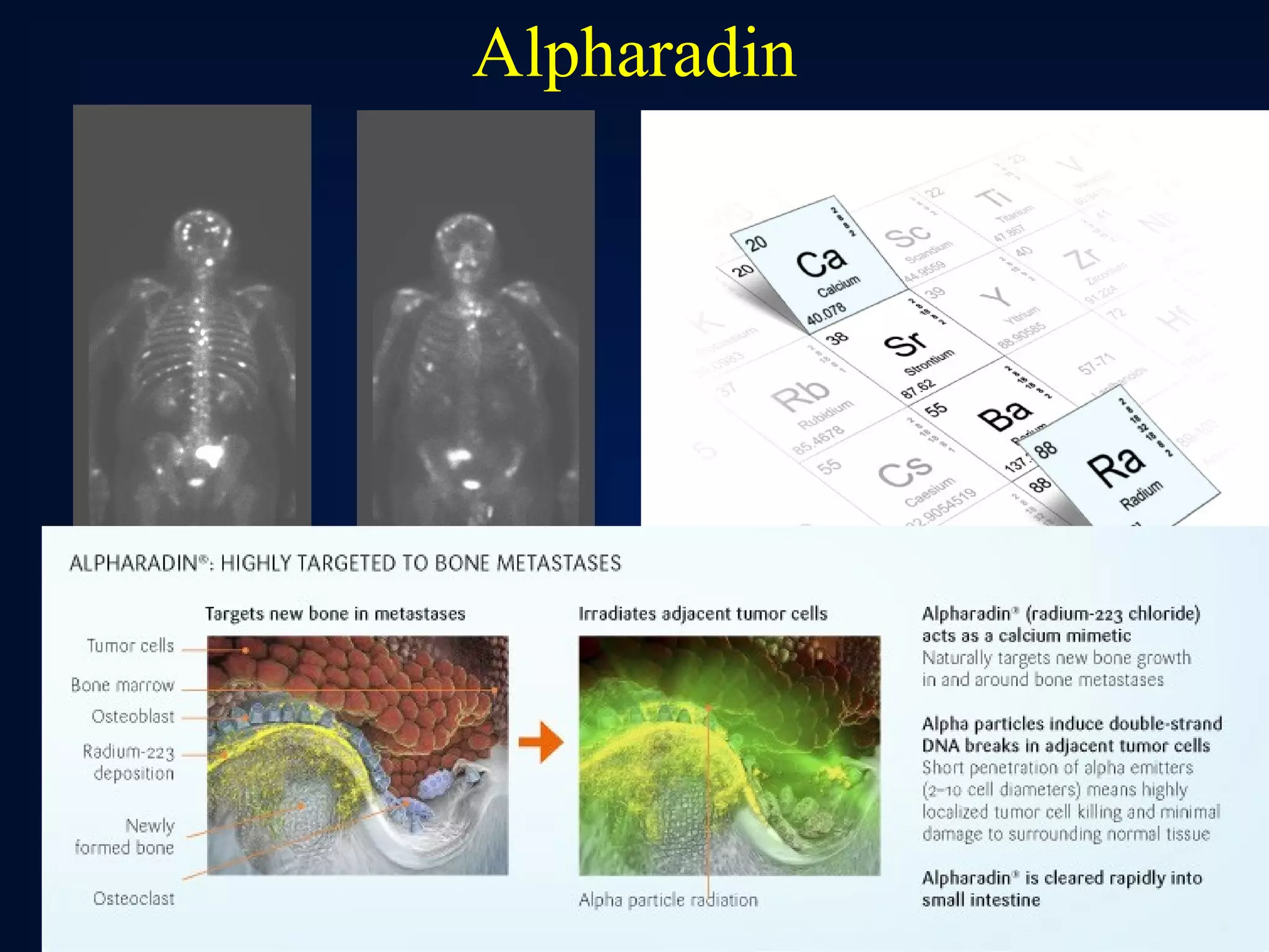 Alpharadin




             61
 