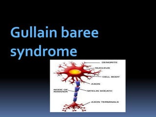 Gullain baree
syndrome
 