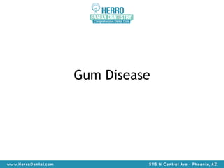 Gum Disease 