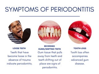 SYMPTOMS OF PERIODONTITIS
Teeth that have
become loose in the
absence of trauma
indicate periodontitis.
Gum tissue that pulls
away from teeth and
teeth shifting out of
place are signs of
periodontitis.
Tooth loss often
accompanies
advanced gum
disease.
LOOSE TEETH TOOTH LOSS
RECEEDING
GUMS/SHIFTING TEETH
 