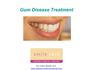 Gum Disease Treatment For more details visit  http://www.smilecareworld.com 