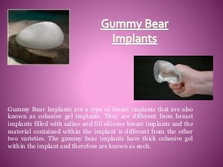 Gummy Bear Implants are a type of breast implants that are also
known as cohesive gel implants. They are different from breast
implants filled with saline and fill silicone breast implants and the
material contained within the implant is different from the other
two varieties. The gummy bear implants have thick cohesive gel
within the implant and therefore are known as such.

 