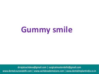 Gummy smile
 