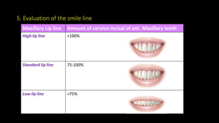5. Evaluation of the smile line
Maxillary Lip line Amount of cervico-incisal of ant. Maxillary teeth
High lip line >100%
Standard lip line 75-100%
Low lip line <75%
 