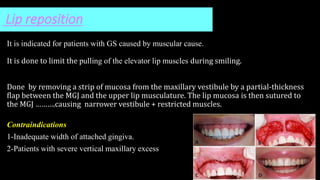 Lip reposition
It is indicated for patients with GS caused by muscular cause.
It is done to limit the pulling of the elevator lip muscles during smiling.
Done by removing a strip of mucosa from the maxillary vestibule by a partial-thickness
flap between the MGJ and the upper lip musculature. The lip mucosa is then sutured to
the MGJ ……….causing narrower vestibule + restricted muscles.
Contraindications
1-Inadequate width of attached gingiva.
2-Patients with severe vertical maxillary excess
 