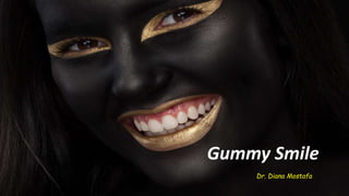 Gummy Smile
Dr. Diana Mostafa
 