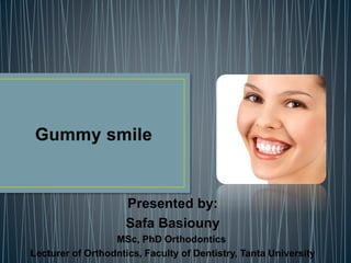 Presented by:
Safa Basiouny
MSc, PhD Orthodontics
Lecturer of Orthodntics, Faculty of Dentistry, Tanta University
 