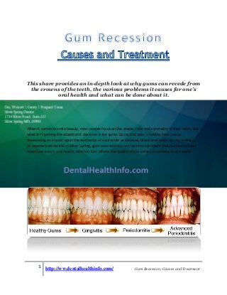 This share provides an in-depth look at why gums can recede from
the crowns of the teeth, the various problems it causes for one’s
oral health and what can be done about it.

When it comes to smile beauty, most people focus on the shape, color and symmetry of their teeth, but
what isn’t getting the attention it deserves is the gums. Gums that aren’t healthy have just as
devastating an impact upon the aesthetics of your smile as decayed, discolored teeth do. According to
an experienced dentist in Silver Spring, gum recession is a very common problem that can have severe
repercussions on oral health, which in turn affects the quality of the smile you present to the world.

1 http://ww.dentalhealthinfo.com/

Gum Recession: Causes and Treatment

 