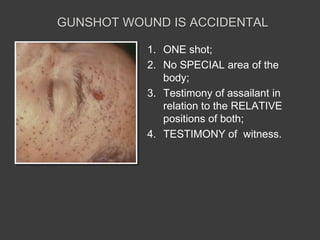 Gunshot and shrapnels | PPTX