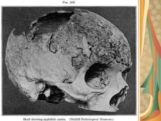 03/12/17 Dr Younas 21
 