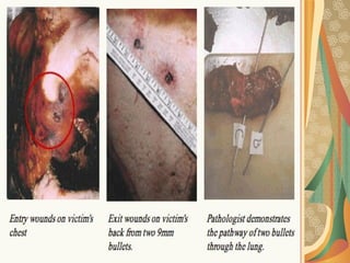 03/12/17 Dr Younas 24
 