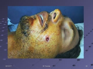 262603/12/1703/12/17 Dr YounasDr Younas
 