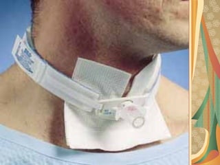 03/12/17 Dr Younas 32
 