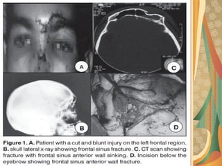 03/12/17 Dr Younas 34
 