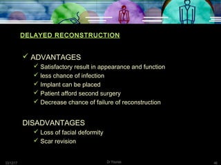 03/12/17 Dr Younas 46
DELAYED RECONSTRUCTION
 ADVANTAGES
 Satisfactory result in appearance and function
 less chance of infection
 Implant can be placed
 Patient afford second surgery
 Decrease chance of failure of reconstruction
DISADVANTAGES
 Loss of facial deformity
 Scar revision
 