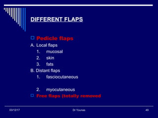 Dr Younas 4903/12/17
DIFFERENT FLAPS
 Pedicle flaps
A. Local flaps
1. mucosal
2. skin
3. fats
B. Distant flaps
1. fasciocutaneous
2. myocutaneous
 Free flaps (totally removed
 