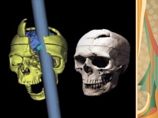 03/12/17 Dr Younas 55
 