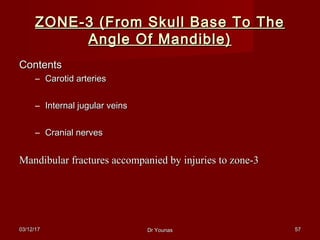 03/12/1703/12/17 Dr YounasDr Younas 5757
ZONE-3 (From Skull Base To TheZONE-3 (From Skull Base To The
Angle Of Mandible)Angle Of Mandible)
ContentsContents
– Carotid arteriesCarotid arteries
– Internal jugular veinsInternal jugular veins
– Cranial nervesCranial nerves
Mandibular fractures accompanied by injuries to zone-3Mandibular fractures accompanied by injuries to zone-3
 