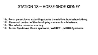 STATION 18 – HORSE-SHOE KIDNEY
18a. Renal parenchyma extending across the midline: horseshoe kidney.
18b. Abnormal contact of the developing metanephric blastema.
18c. The inferior mesenteric artery.
18d. Turner Syndrome, Down syndrome, VACTERL, MRKH Syndrome
 