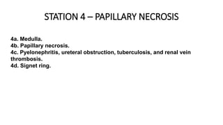 4a. Medulla.
4b. Papillary necrosis.
4c. Pyelonephritis, ureteral obstruction, tuberculosis, and renal vein
thrombosis.
4d. Signet ring.
STATION 4 – PAPILLARY NECROSIS
 