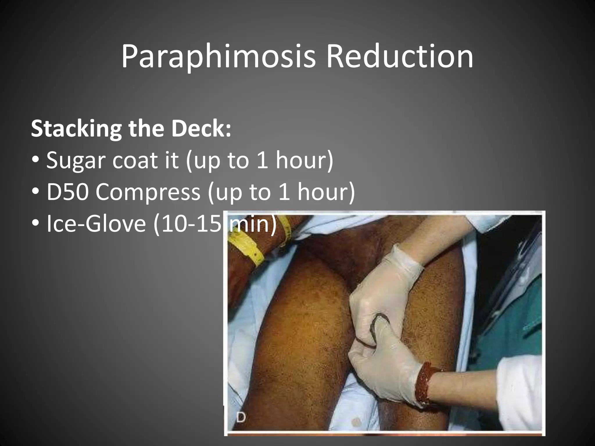 urologic-procedures-in-the-emergency-department-pptx