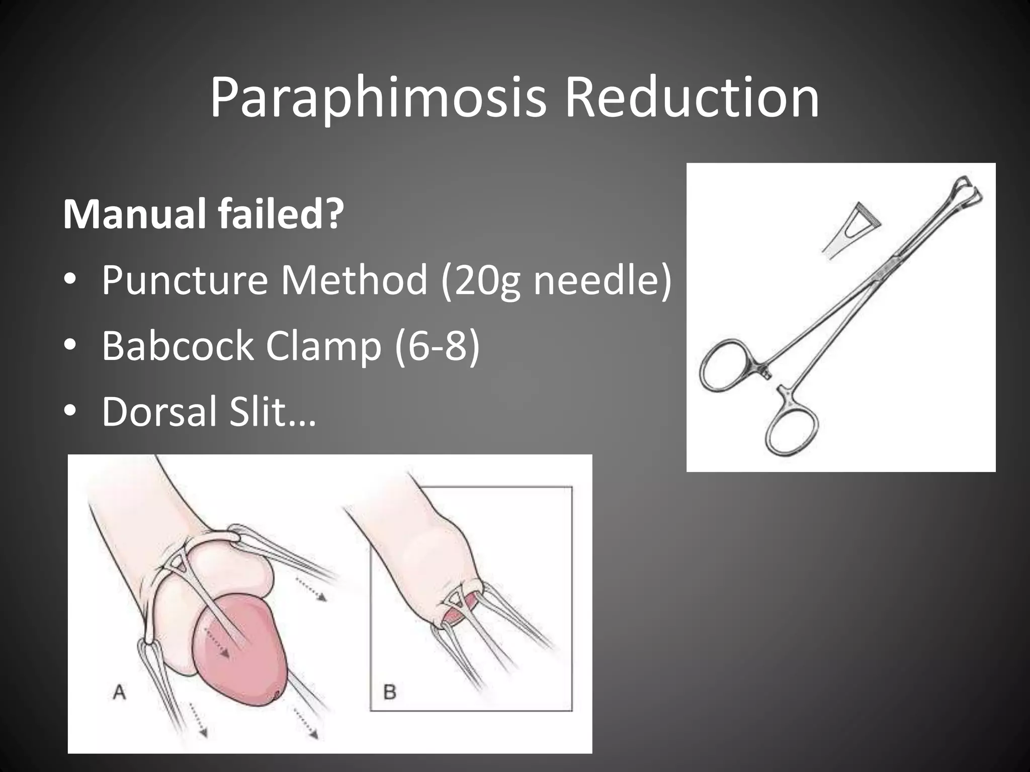 urologic-procedures-in-the-emergency-department-pptx