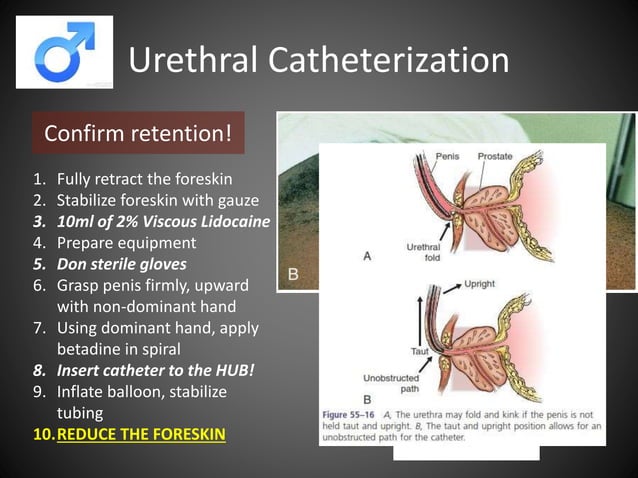 Urologic Procedures in the Emergency Department | PPTX