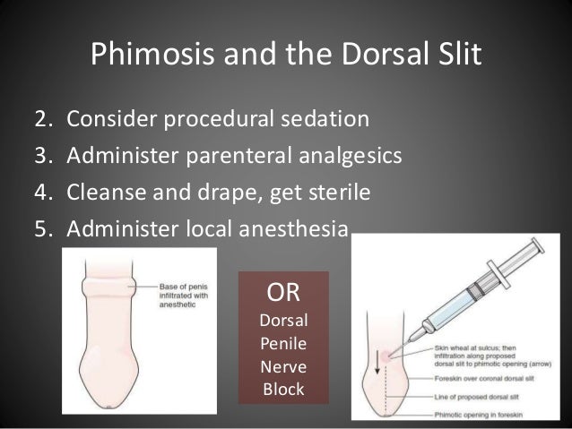 Urologic Procedures In The Emergency Department