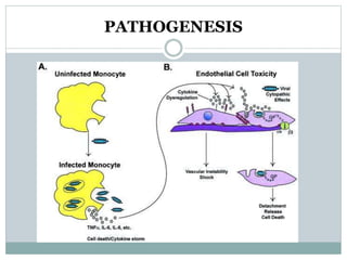 PATHOGENESIS 
 