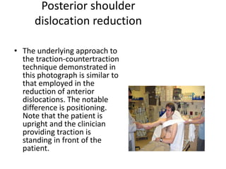 Shoulder Reduction Note dislocations of shoulder dr.guru prasad | PPTX