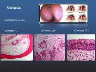 Cornetes 
(Hematoxilina-eosina) 
Cornetes 4X Cornetes 10X Cornetes 40X 
 