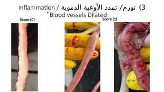 )3
‫تور‬
/‫م‬
‫الدموية‬ ‫األوعية‬ ‫تمدد‬
Inflammation /
Blood vessels Dilated
"
Score (0) Score (1)
 
