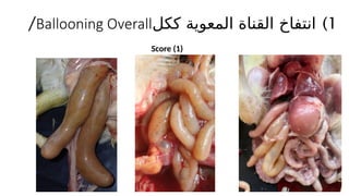 )1
‫ككل‬ ‫المعوية‬ ‫القناة‬ ‫انتفاخ‬
Ballooning Overall
/
Score (1)
 