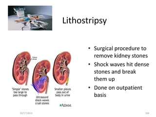 Lithostripsy
• Surgical procedure to
remove kidney stones
• Shock waves hit dense
stones and break
them up
• Done on outpatient
basis
10/17/2013

104

 