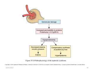How many pathological types
causes nephrotic syndrome?

10/17/2013

45

 