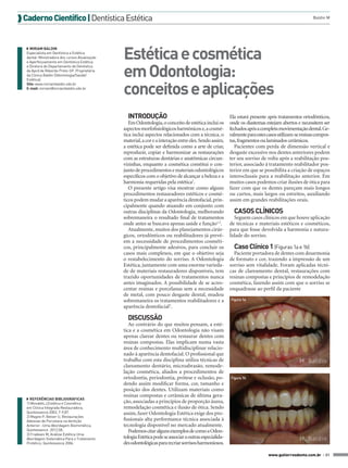  Caderno Científico | Dentística Estética

◗ MIRIAM BALDIN
Especialista em Dentística e Estética
dental. Ministradora dos cursos Atualização
e Aperfeiçoamento em Dentística Estética
e Diretora do Departamento de Dentística
da Apcd de Ribeirão Preto-SP. Proprietária
da Clinica Baldin (Odontologia/Saúde/
Estética).
Site: www.miriambaldin.odo.br
E-mail: miriam@miriambaldin.odo.br

Baldin M

Estética e cosmética
em Odontologia:
conceitos e aplicações
INTRODUÇÃO
Em Odontologia, o conceito de estética inclui os
aspectos morfofisiológicos harmônicos e, a cosmética inclui aspectos relacionados com a técnica, o
material, a cor e a interação entre eles. Sendo assim,
a estética pode ser definida como a arte de criar,
reproduzir, copiar e harmonizar as restaurações
com as estruturas dentárias e anatômicas circunvizinhas, enquanto a cosmética constitui o conjunto de procedimentos e materiais odontológicos
específicos com o objetivo de alcançar a beleza e a
harmonia requeridas pela estética1.
O presente artigo visa mostrar como alguns
procedimentos restauradores estéticos e cosméticos podem mudar a aparência dentofacial, principalmente quando atuando em conjunto com
outras disciplinas da Odontologia, melhorando
sobremaneira o resultado final de tratamentos
onde antes se buscava apenas saúde e função1,2.
Atualmente, muitos dos planejamentos cirúrgicos, ortodônticos ou reabilitadores já prevêem a necessidade de procedimentos cosméticos, principalmente adesivos, para concluir os
casos mais complexos, em que o objetivo seja
o restabelecimento do sorriso. A Odontologia
Estética, juntamente com uma enorme variedade de materiais restauradores disponíveis, tem
trazido oportunidades de tratamentos nunca
antes imaginados. A possibilidade de se acrescentar resinas e porcelanas sem a necessidade
de metal, com pouco desgaste dental, mudou
sobremaneira os tratamentos reabilitadores e a
aparência dentofacial3.

Ela estará presente após tratamentos ortodônticos,
onde os diastemas estejam abertos e necessitem ser
fechados após a completa movimentação dental. Geralmente para estes casos utilizam-se resinas compostas, fragmentos ou laminados cerâmicos.
Pacientes com perda de dimensão vertical e
desgaste excessivo nos dentes anteriores podem
ter seu sorriso de volta após a reabilitação posterior, associado à tratamento reabilitador posterior em que se possibilita a criação de espaços
interoclusais para a reabilitação anterior. Em
muitos casos podemos criar ilusões de ótica para
fazer com que os dentes pareçam mais longos
ou curtos, mais largos ou estreitos, auxiliando
assim em grandes reabilitações orais.

CASOS CLÍNICOS
Seguem casos clínicos em que houve aplicação
de técnicas e materiais estéticos e cosméticos,
para que fosse devolvida a harmonia e naturalidade do sorriso.

Caso Clínico 1 (Figuras 1a e 1b)
Paciente portadora de dentes com desarmonia
de formato e cor, trazendo a impressão de um
sorriso sem vitalidade. Foram aplicadas técnicas de clareamento dental, restaurações com
resinas compostas e princípios de remodelação
cosmética, fazendo assim com que o sorriso se
enquadrasse ao perfil da paciente
Figura 1a

DISCUSSÃO

◗ REFERÊNCIAS BIBLIOGRÁFICAS
1) Mondelli,J,Estética e Cosmética
em Clínica Integrada Restauradora,
Quintessence.2003, 7-9,87.
2) Magne P, Belser U, Restaurações
Adesivas de Porcelana na dentição
Anterior: :Uma Abordagem Biomimética,
Quintessence .2012;58.
3) Fradeani M, Análise Estética Uma
Abordagem Sistemática Para o Tratamento
Protético, Quintessence.2006.

Ao contrário do que muitos pensam, a estética e a cosmética em Odontologia não visam
apenas clarear dentes ou restaurar dentes com
resinas compostas. Elas implicam numa vasta
área de conhecimento multidisciplinar relacionado à aparência dentofacial. O profissional que
trabalha com esta disciplina utiliza técnicas de
clareamento dentário, microabrasão, remodelação cosmética, aliados a procedimentos de
ortodontia, periodontia, prótese e oclusão, podendo assim modificar forma, cor, tamanho e
posição dos dentes. Utilizam materiais como
resinas compostas e cerâmicas de última geração, associadas a princípios de proporção áurea,
remodelação cosmética e ilusão de ótica. Sendo
assim, fazer Odontologia Estética exige dos profissionais alta performance técnica associada à
tecnologia disponível no mercado atualmente.
Podemos citar alguns exemplos de como a Odontologia Estética pode se associar a outras especialidades odontológicas para recriar sorrisos harmoniosos.

M. Baldin
Figura 1b

M. Baldin
www.gutierreodonto.com.br > 31

 