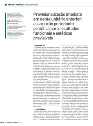  Caderno Científico | Implantodontia

◗◗ GLAUBER MACEDO RAMA
Especialista em Periodontia pela
Associação Odontológica de Ribeirao
Preto (Aorp). Mestrando em Reabilitação
Oral pela Faculdade de Odontologia de
Ribeirão Preto da Universidade
de São Paulo (Forp/Usp).
E-mail: glauber.rama@gmail.com
◗◗ DANILO MAEDA REINO
Especialista, Mestre e Doutorando em
Periodontia pela Faculdade de Odontologia
de Ribeirão Preto da Universidade
de São Paulo (Forp/Usp).
◗◗ FELIPE ANDERSON SOUSA DOS SANTOS
Especialista em Periodontia pela
Associação Odontológica de Ribeirao
Preto (Aorp). Mestrando em Periodontia
pela Faculdade de Odontologia
de Ribeirão Preto da Universidade
de São Paulo (Forp/Usp).

Provisionalização imediata
em dente unitário anterior:
associação periodontoprotética para resultados
funcionais e estéticos
previsíveis
INTRODUÇÃO
O panorama atual da implantodontia mostra-se bastante evoluído, com inúmeras técnicas e
materiais que propiciam a resolução de casos
que antes não seriam possíveis ou implicariam
em inúmeros procedimentos reconstrutivos
prévios para que uma tentativa de implantação
pudesse ser alcançada. A evolução técnico-científica hoje tem por um de seus principais pilares
não apenas o favorecimento da biocompatibilidade, mas também a redução dos tempos de
espera pelo paciente para que este possa receber
seu tratamento definitivo.
Na clínica diária a provisionalização imediata
de implantes unitários é um dos procedimentos
mais desejados por pacientes e dentistas, seja em
dentes anteriores ou posteriores. Tal procedimento permite que o paciente possa receber um
elemento provisório que, apesar de não possuir
função mastigatória efetiva, devolve conforto
estético, psicológico e social a ele durante o período de osseointegração.
O tempo da osseointegração, entretanto, ainda é uma queixa por parte dos profissionais e
pacientes. Dessa forma, inúmeras pesquisas relacionadas à modificação da superfície de implantes osseointegráveis têm sido realizadas. Existem
alternativas que permitem reduzir sensivelmente o tempo de espera de 6 meses para até 3 a 4
semanas em algumas situações específicas1.
Este relato de caso clínico tem por objetivo
demonstrar uma provisionalização imeditada
em um implante imediato unitário no qual
foram utilizados tanto técnicas modernas de
implantação associadas ao uso de biomateriais
e técnicas de cirurgia plástica peri-implantar
para otimização estética a longo prazo, aliado
ao uso de um implante com tratamento de superfície ativa.

CASO CLÍNICO
Paciente de 38 anos do gênero feminino, sem
comprometimento sistêmico, compareceu à
CEEC Odontologia com relato de reabsorção
radicular externa do elemento 21 confirmada
clínica (mobilidade) e radiograficamente (Figuras 1 e 2). O planejamento protético/periodontal
44 > Revista Gutierre Odontolife - EDIÇÃO 57

reverso por meio de exames clínico, radiográfico
e por fotografias intra e extrabucais realizado,
consistiu na exodontia minimamente traumática do elemento 21, implantação imediata em
alvéolo fresco associada à utilização de biomateriais de preenchimento do “gap” vestibular de
lenta absorção e enxerto de tecido conjuntivo e,
se possível, provisionalização imediata.
Após realizada a anestesia local na área de
trabalho, procedeu-se à desinserção delicada
do elemento 21 por meio de um periótomo
delgado. A porção coronária do elemento
foi removida com uma pinça hemostática e
preconizou-se a remoção da porção radicular por meio de um extrator atraumático de
raízes. Para tal, a sequência preconizada pelo
fabricante foi seguida e a porção radicular foi
removida mantendo-se a integridade do alvéolo, incluindo as papilas gengivais (Figuras 3 e
4). Durante a inspeção alveolar, notou-se que
as paredes ósseas estavam íntegras situando-se
cerca de 3 mm abaixo da margem gengival em
todas as paredes. Dessa forma, procedeu-se à
sequência de fresagem para a implantação por
meio de uma cirurgia “flapless”, ou seja, sem
abertura de retalho. O implante utilizado (Neodent Drive Acqua CM 3.5 x 13,0 mm) consiste
de um implante cônico de alta performance dotado de um tratamento de superfície ativo que
têm mostrado resultados interessantes no quesito
redução do tempo de espera pela osseointegração.
O procedimento de implantação seguiu a abordagem de “approach palatino”, técnica esta que
busca ancoragem apical na tábua óssea palatina,
porém com a emergência do implante rumo ao
seu posicionamento protético ideal, ou seja, entre
borda incisal e cíngulo para dentes anteriores e no
centro da face oclusal para posteriores, mantendo-se uma área vazia entre o implante e a tábua
óssea vestibular denominada “gap” (Figura 5).
Após a instalação do implante, o torque de
inserção foi aferido a fim de se checar a possibilidade de provisionalização imediata sem riscos,
ou seja, dentro da faixa de 30-45N2. Feito isso,
procedeu-se à seleção do pilar a ser instalado
para a provisionalização. Por meio de um kit
de seleção protética apropriado, selecionou-

 