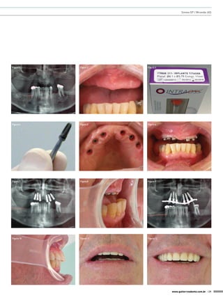 Sinnes EP / Miranda JAS




Figura 1    Figura 2    Figura 3




Figura 4    Figura 5    Figura 6




Figura 7    Figura 8    Figura 9




Figura 10   Figura 11   Figura 12




                                    www.gutierreodonto.com.br > 29
 