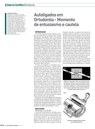 Caderno Científico | Ortodontia



                                                     Autoligados em
     ◗◗ Mauricio Accorsi
     Especialista em Ortodontia e Ortopedia
     Facial pela Universidade Federal do Paraná
     (UFPR). Preceptor em Dor Orofacial e


                                                     Ortodontia - Momento
     Disfunção pela Universidade da Califórnia
     em Los Angeles (UCLA). Mestre em
     Ortodontia pela Faculdade de Odontologia
     da Universidade de São Paulo (Fo/Usp-


                                                     de entusiasmo e cautela
     SP). Autor do livro “DIAGNÓSTICO 3D EM
     ORTODONTIA - A Tomografia Cone-beam
     Aplicada” (Editora Napoleão). Professor
     convidado dos cursos de Especialização
     em Ortodontia da Universidade Federal do
     Paraná (UFPR), Universidade Positivo (UP), em
     Curitiba-PR e da Universidad Autónoma de
     Baja Califórnia (UABC) em Mexicali, México.
     Fone: (41) 3253-6816
                                                       Introdução                                              bráquete (clip ativo) pressiona o fio dentro da
     Site: www.aortodontia.com.br                       Em função da baixa fricção, algumas vanta-             canaleta; passivos, quando o sistema permite
                                                     gens são atribuídas às mecânicas com sistemas             liberdade do fio dentro canaleta; ou interativos,
                                                     de bráquetes autoligados (SBA). Elas residem              quando os bráquetes autoligados exercem pressão
                                                     principalmente na redução do tempo total de               em fios mais espessos, mas permitem liberdade
                                                     tratamento, aumento do conforto e higiene para            de fios menos calibrosos. Quando um sistema
                                                     os pacientes e praticidade e diminuição do tempo          de bráquetes ativo é utilizado, a fricção é bem
                                                     de cadeira para os ortodontistas1. Além disso, a          maior do que quando se utiliza um sistema de
                                                     diminuição da frequência das extrações e expan-           bráquetes passivos. Um exemplo de bráquete to-
                                                     sões cirurgicamente assistidas são também citadas         talmente passivo é o Portia® (Figura 02) lançado
                                                     na literatura1,2. Mecânicas de deslizamento tam-          recentemente no Brasil pela companhia Abzil 3M.
                                                     bém estariam facilitadas, diminuindo-se as ne-            Como vimos anteriormente, alguns cuidados são
                                                     cessidades de ancoragem. Dessa forma, em 2008,            necessários para se obter todos os benefícios da
                                                     42% dos ortodontistas americanos1 admitiram               utilização dos SBA. Primeiro, quando de faz op-
                                                     a utilização de pelo menos um desses sistemas,            ção por uma mecânica de baixa fricção, parece-
                                                     em comparação com apenas 8,7% em 2002. No                 -nos mais coerente utilizar um SBA passivo.
                                                     Brasil, o uso desses aparelhos cresce exponen-               Não se pode utilizar nos SBA uma sequência
                                                     cialmente, com quase todas as marcas comerciais           convencional de fios, pois os ganhos de espaço
                                                     presentes no país, disponibilizando pelo menos            no perímetro do arco, a rapidez e eficiência nas
                                                     uma versão desses sistemas.                               fases de alinhamento e nivelamento, e os benefí-
                                                        De fato, são inegáveis as vantagens que o
                                                     conceito apresenta, levando-se a ganhos quan-
                                                     tificados tanto para pacientes, quanto para os            Figura 1
                                                     profissionais. Entretanto, os SBA requerem uma
                                                     nova curva de aprendizado, pois sua utilização
                                                     difere dos sistemas convencionais em aspectos
                                                     importantes. Além disso, o marketing dos fa-
                                                     bricantes tende a relacionar a “baixa fricção”,
                                                     que é a maior vantagem mecânica atribuída
                                                     aos sistemas, apenas com o método de ligação
                                                     dos bráquetes, relegando a um segundo plano                “Biding ou travamento” refere-se ao efeito de fricção
                                                     fatores fundamentais, como os efeitos de “bin-             gerado pelo contato do arco com as bordas das aletas
                                                     ding” e “notching” (Figura 01). A distância inter-         dos braquetes, quando o movimento dentário começa
                                                     -bráquetes, as forças da mastigação e presença            a acontecer. “Notching”, ou “deformação permanente”
                                                     de saliva também são fatores muito relevantes,            ocorre quando a interface aletas-arco fica travada por
                                                     assim como o tipo e qualidade dos fios e brá-                     uma deformação irreversível do arco.
                                                     quetes empregados, grau de má-oclusão inicial
                                                     e, principalmente, a resposta individual do com-          Figura 2
                                                     plexo neuromuscular e das estruturas de suporte
                                                     dento-alveolares de cada indivíduo.
                                                        Finalmente, em uma abordagem contemporânea,
                                                     a Ortodontia não pode prescindir de uma prática
                                                     clínica baseada em evidências científicas e a literatu-
                                                     ra ainda carece de pesquisas realizadas “in vivo”, pois
                                                     a maioria dos estudos que demonstram a redução
                                                     da fricção nos SBA foram realizados “in vitro”.

                                                       DISCUSSÃO
                                                        Otimizando o uso dos SBA
                                                        A força de fricção pode ser definida como a
                                                     resistência que ocorre entre duas superfícies que
                                                     se opõem ao movimento na mesma direção, mas
                                                     em sentidos opostos2-4. Ao contrário dos brá-
                                                     quetes tradicionais, os SBA não necessitam de
                                                     ligaduras, sejam elas elásticas ou metálicas. Os                     Braquete autoligado passivo Portia®,
                                                     sistemas podem ser ativos, quando o próprio                                da companhia Abzil 3M.

48 > Revista Gutierre Odontolife - EDIÇÃO 53
 