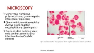 Gram Polymorphs INFECTIVE SYNDROMES OF GENITAL TRACT-1 Part 1 SK | PPTX