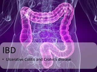 IBD
• Ulcerative Colitis and Crohn's disease
 