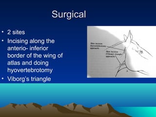 Surgical
• 2 sites
• Incising along the
  anterio- inferior
  border of the wing of
  atlas and doing
  hyovertebrotomy
• Viborg’s triangle
 