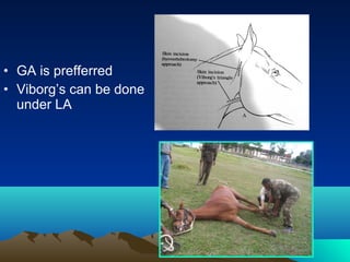 • GA is prefferred
• Viborg’s can be done
  under LA
 