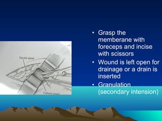 • Grasp the
  memberane with
  foreceps and incise
  with scissors
• Wound is left open for
  drainage or a drain is
  inserted
• Granulation
  (secondary intension)
 