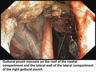 Guttural pouch mycosis on the roof of the medial
compartment and the lateral wall of the lateral compartment
of the right guttural pouch
 