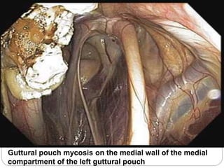 Guttural pouch mycosis on the medial wall of the medial
compartment of the left guttural pouch
 