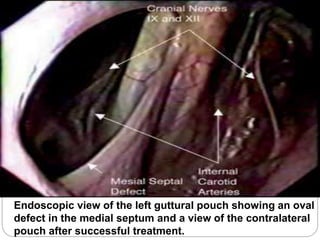 Endoscopic view of the left guttural pouch showing an oval
defect in the medial septum and a view of the contralateral
pouch after successful treatment.
 